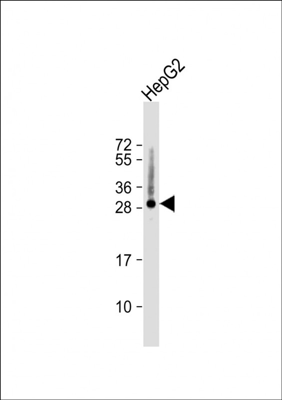 Western Blot at 1:1000 dilution + HepG2 whole cell lysate Lysates/proteins at 20 ug per lane.