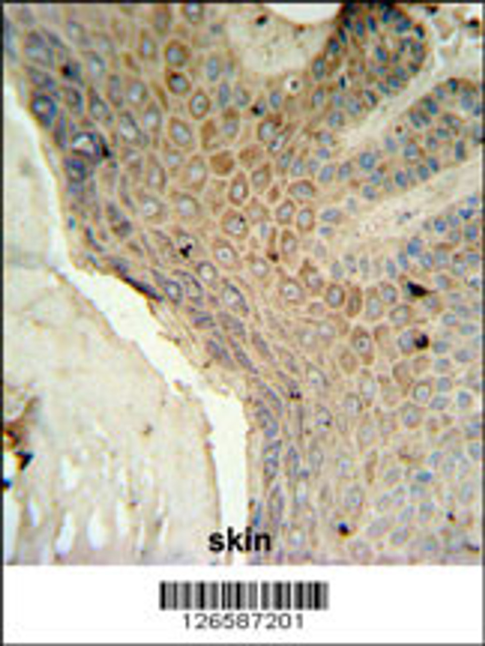 MFSD3 Antibody IHC analysis in formalin fixed and paraffin embedded human skin tissue followed by peroxidase conjugation of the secondary antibody and DAB staining.