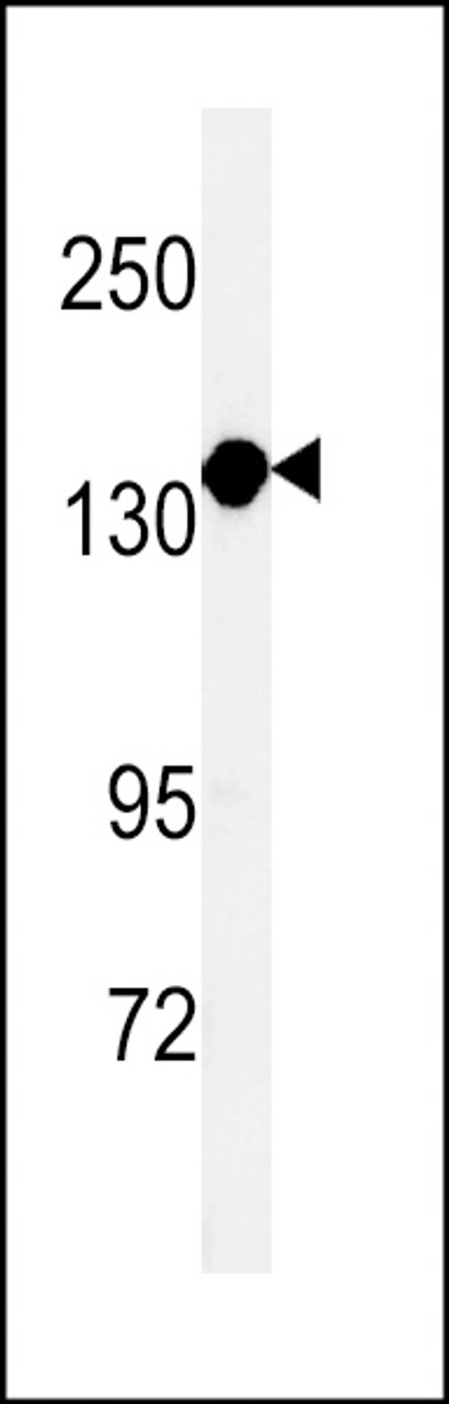 Western blot analysis of MTMRF Antibody in K562 cell line lysates (35ug/lane)