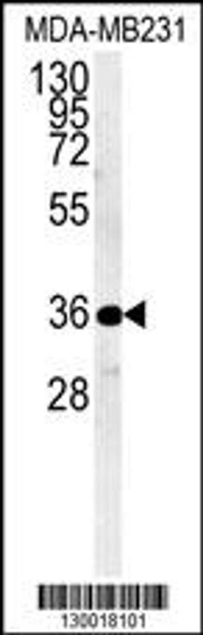 Western blot analysis of MYOZ1 Antibody in MDA-MB231 cell line lysates (35ug/lane)