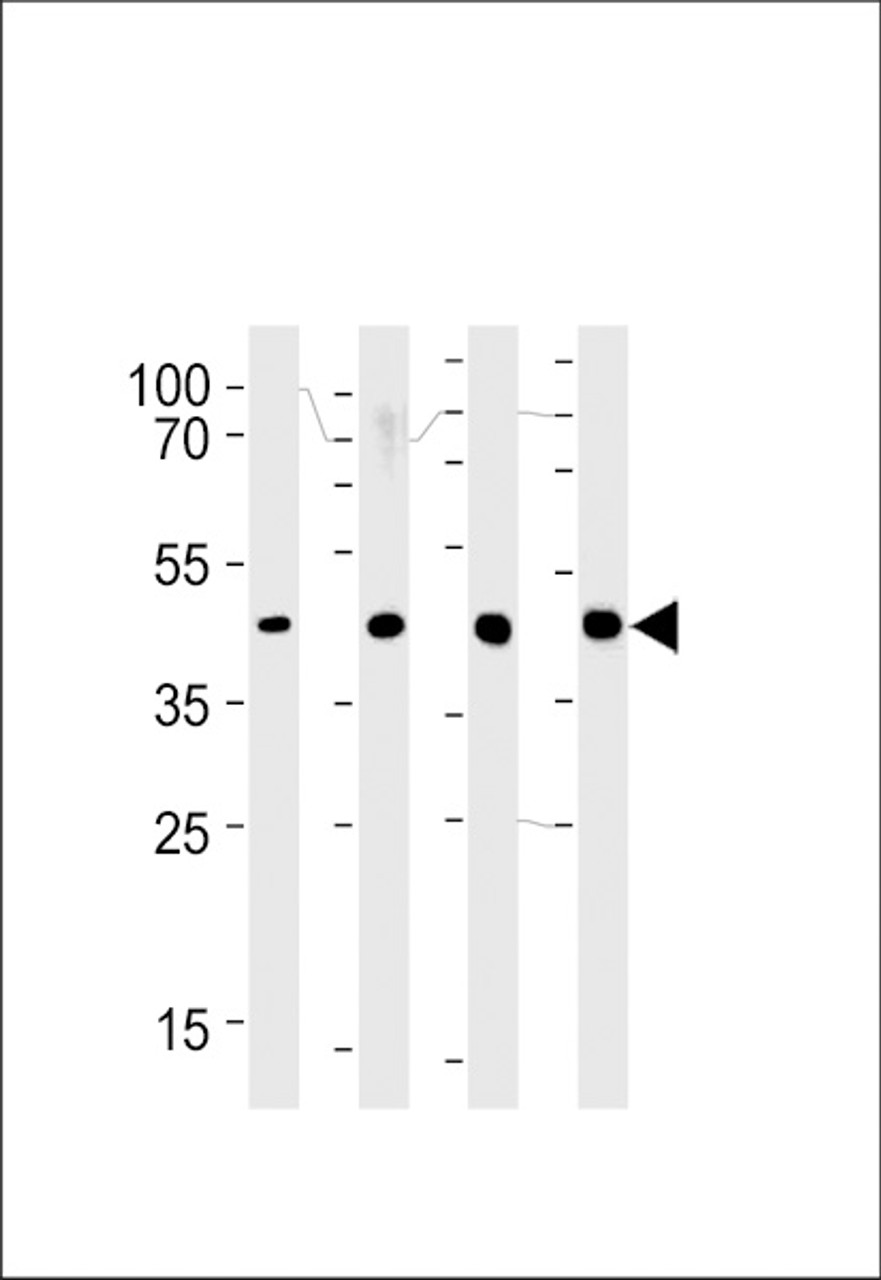 Western blot analysis in 293, LNCaP, PC-3, NCI-H292 cell line lysates (35ug/lane) .
