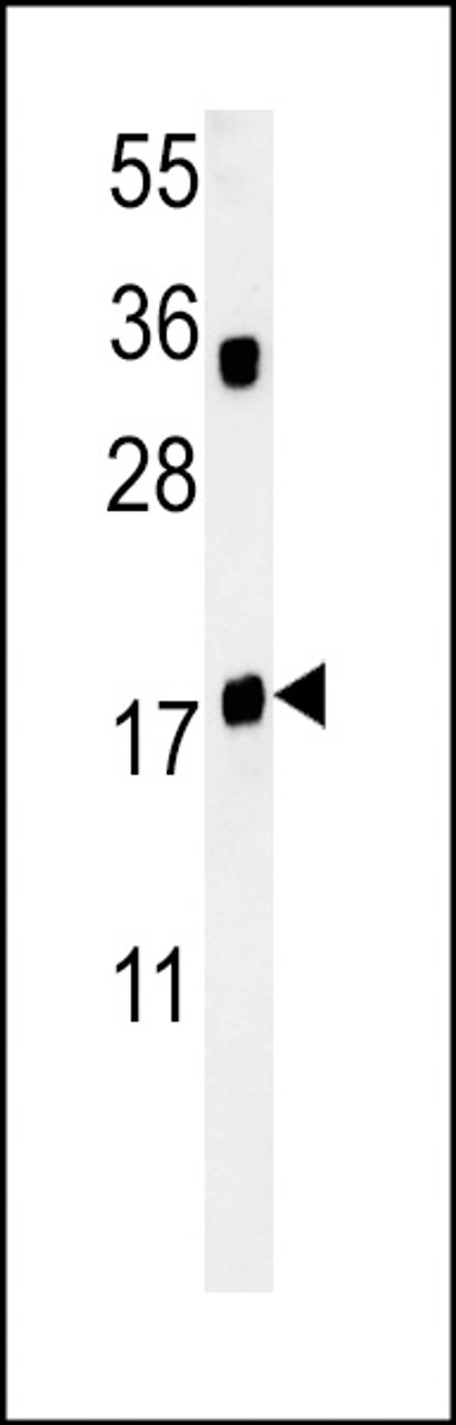 Western blot analysis in Jurkat cell line lysates (35ug/lane) .  This demonstrates the TPC6A antibody detected the TPC6A protein (arrow) .
