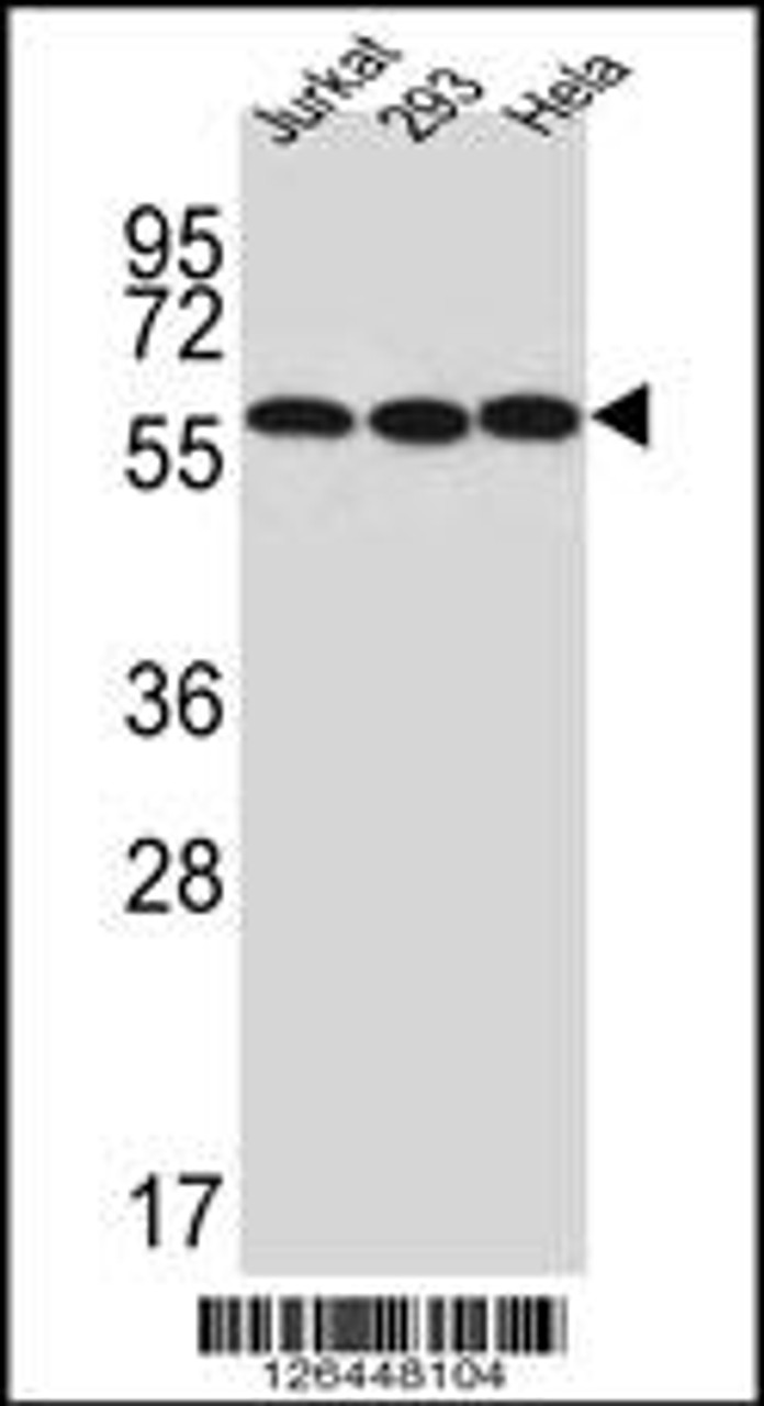 Western blot analysis of UTP6 Antibody in Jurkat, 293, Hela cell line lysates (35ug/lane)