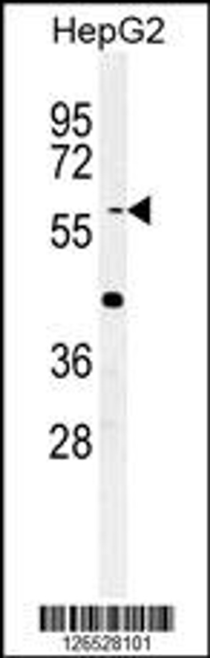 Western blot analysis of YLAT2 Antibody in HepG2 cell line lysates (35ug/lane)