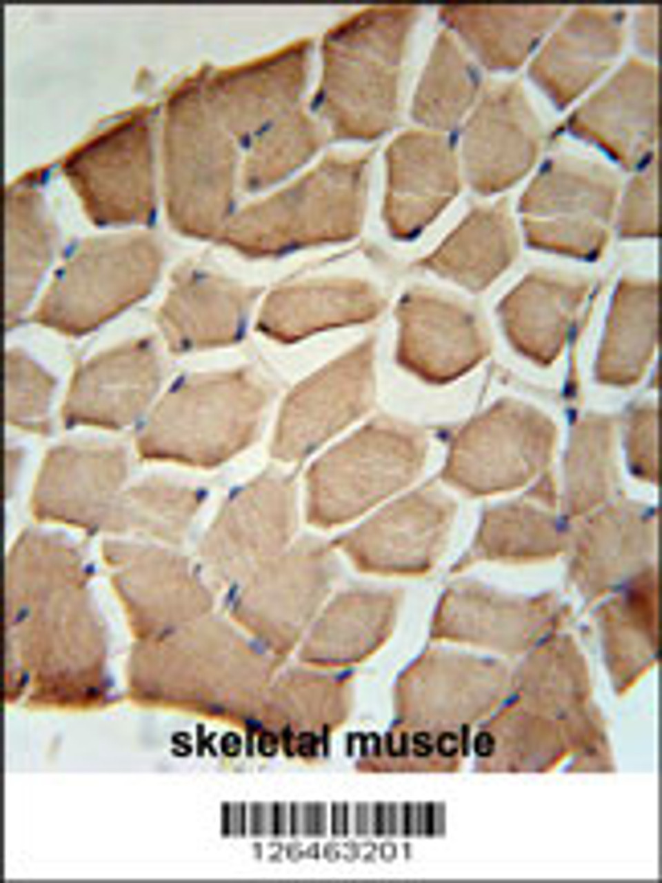NPAL3 Antibody immunohistochemistry analysis in formalin fixed and paraffin embedded human skeletal muscle followed by peroxidase conjugation of the secondary antibody and DAB staining.