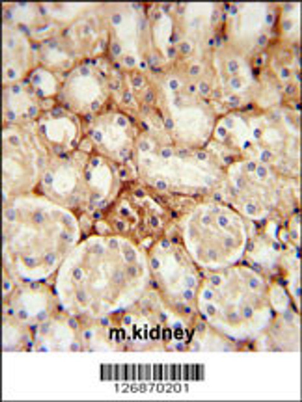 ATP5J2 Antibody immunohistochemistry analysis in formalin fixed and paraffin embedded mouse kidney tissue followed by peroxidase conjugation of the secondary antibody and DAB staining.