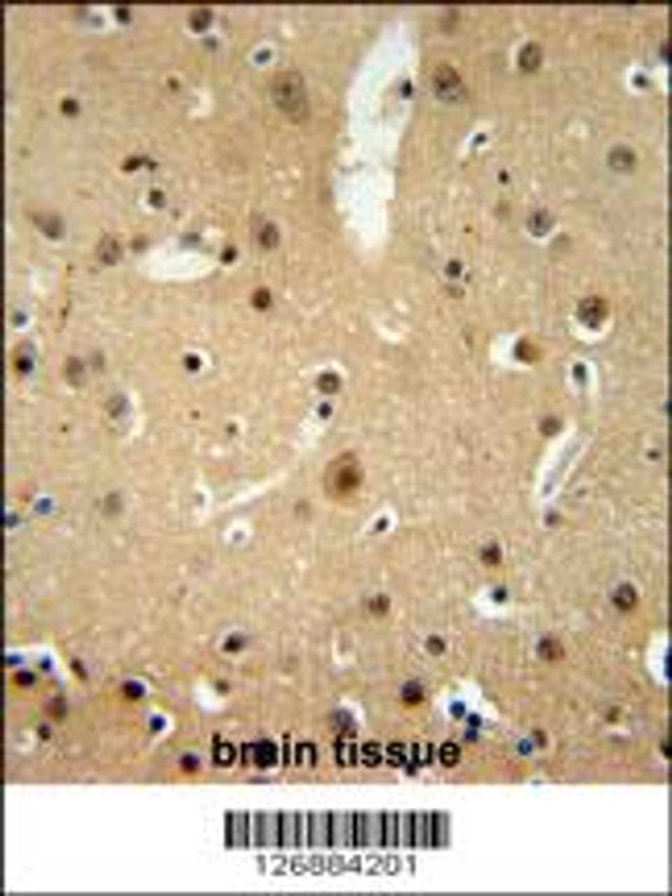 NMB Antibody immunohistochemistry analysis in formalin fixed and paraffin embedded human brain tissue followed by peroxidase conjugation of the secondary antibody and DAB staining.