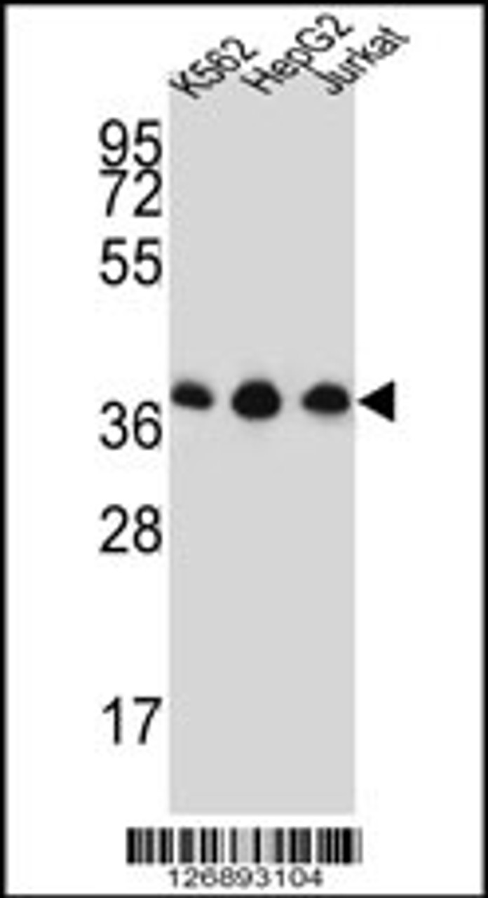 Western blot analysis in K562, HepG2, Jurkat cell line lysates (35ug/lane) .