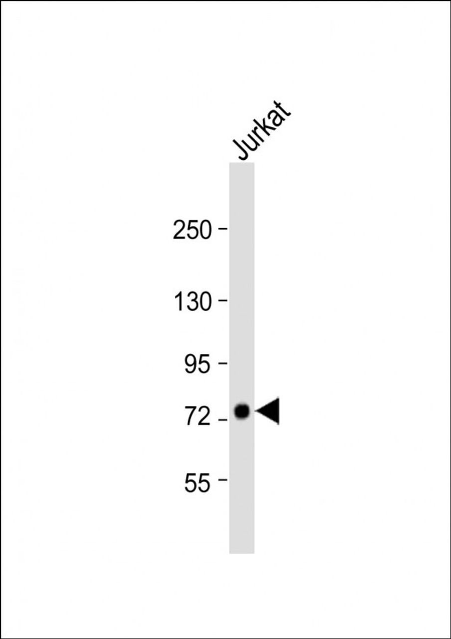 Western Blot at 1:1000 dilution + Jurkat whole cell lysate Lysates/proteins at 20 ug per lane.