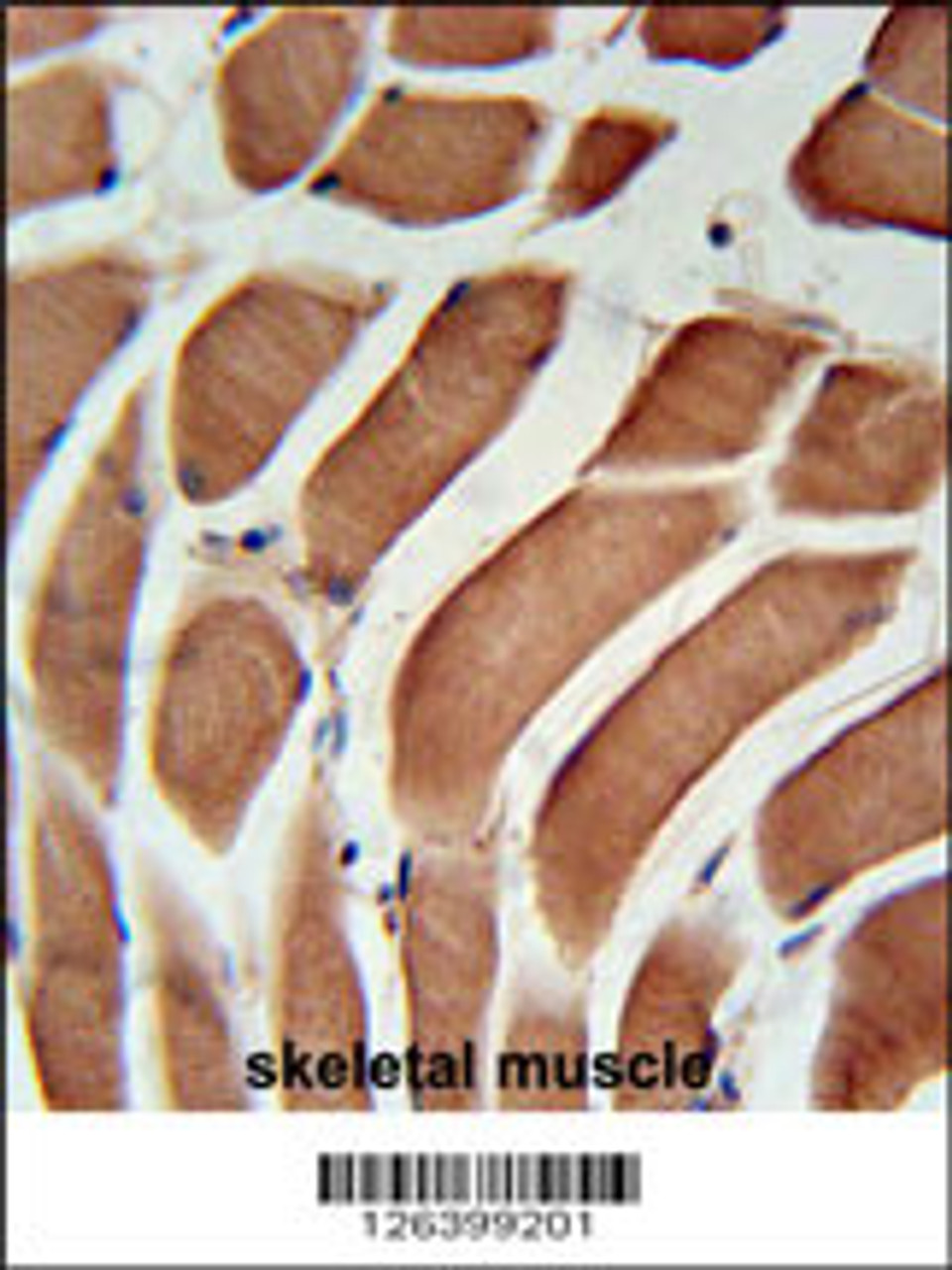 SIKE Antibody immunohistochemistry analysis in formalin fixed and paraffin embedded human skeletal muscle followed by peroxidase conjugation of the secondary antibody and DAB staining.