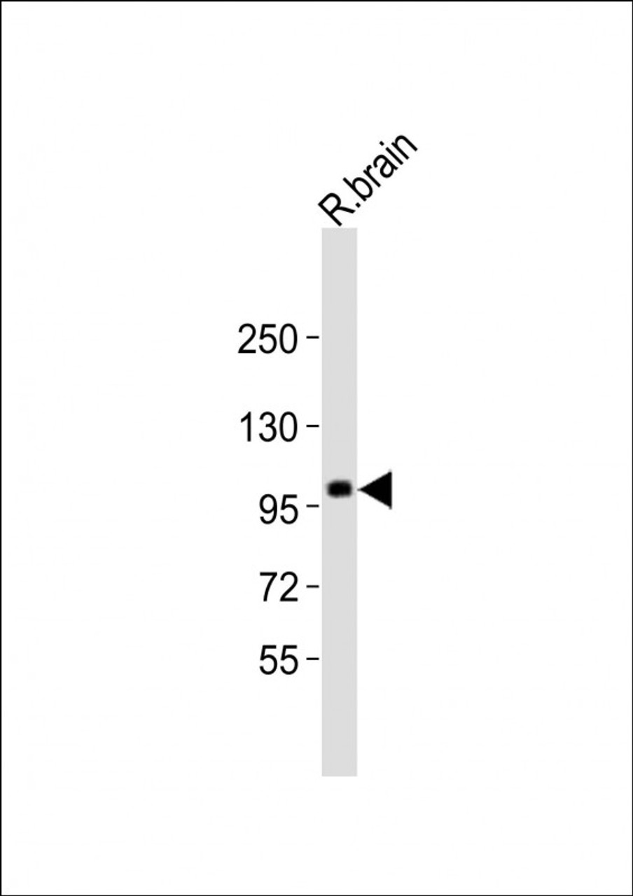 Western Blot at 1:2000 dilution + rat brain lysates Lysates/proteins at 20 ug per lane.