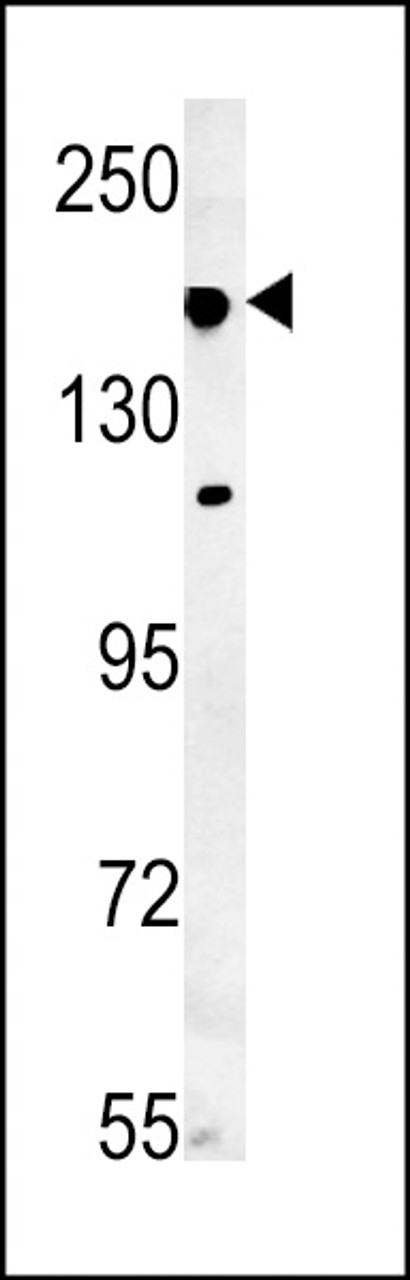 Western blot analysis in mouse lung tissue lysates (35ug/lane) .This demonstrates the detected IFT172 protein (arrow) .