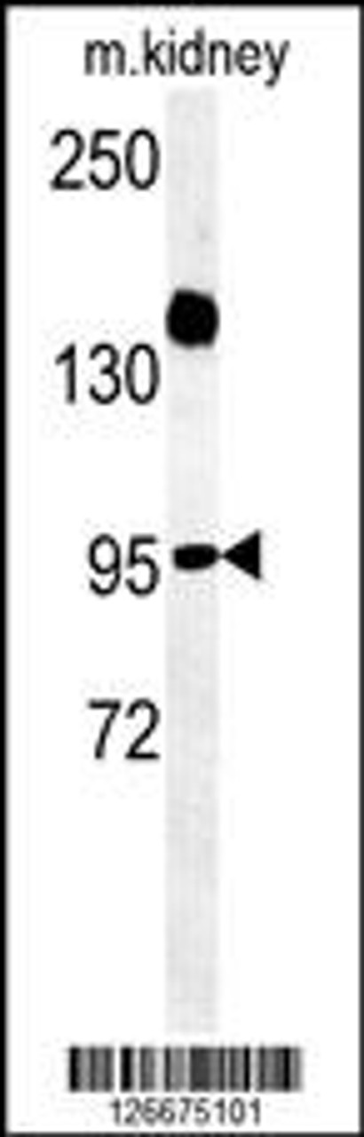 Western blot analysis in mouse kidney tissue lysates (35ug/lane) .This demonstrates the detected ARMC5 protein (arrow) .