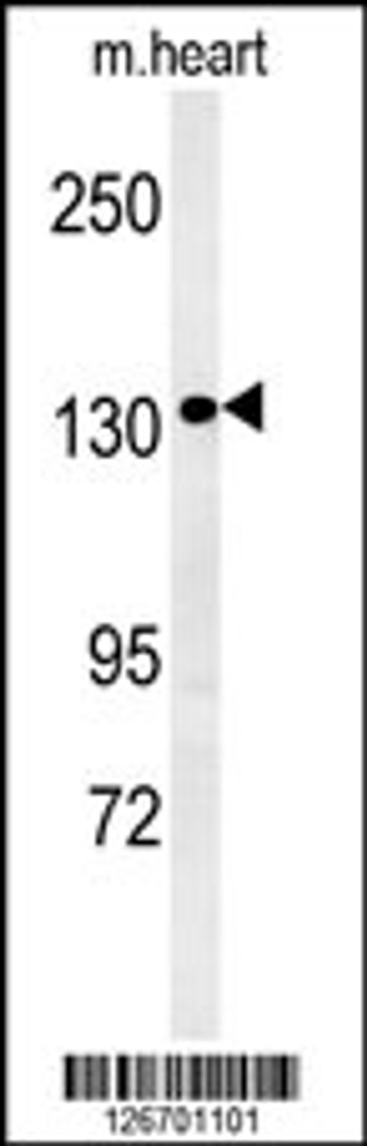 Western blot analysis in mouse heart tissue lysates (35ug/lane) .This demonstrates the ANKRD32 antibody detected ANKRD32 protein (arrow) .