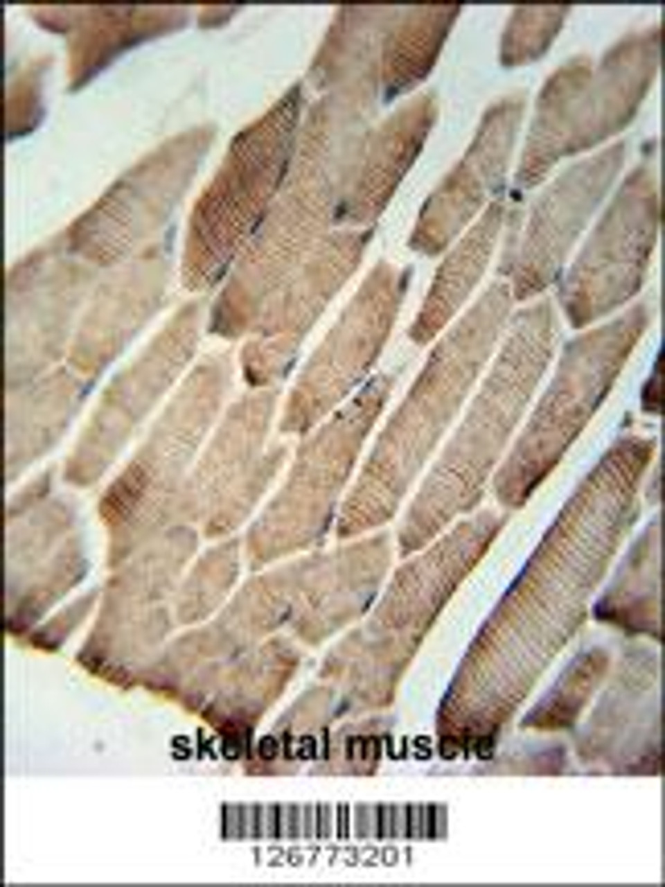 SLC9A9 Antibody immunohistochemistry analysis in formalin fixed and paraffin embedded human skeletal muscle followed by peroxidase conjugation of the secondary antibody and DAB staining.