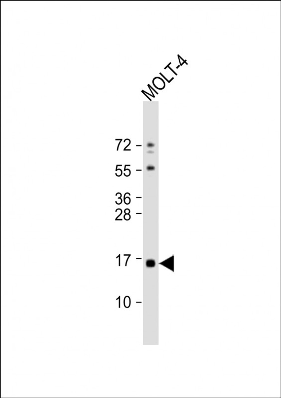 Western Blot at 1:1000 dilution + MOLT-4 whole cell lysate Lysates/proteins at 20 ug per lane.