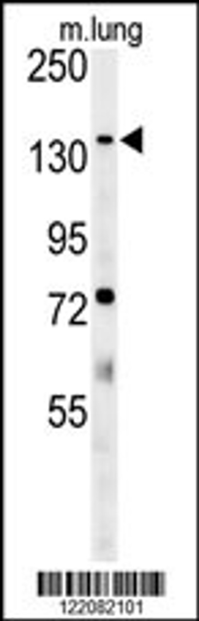 Western blot analysis in mouse lung tissue lysates (35ug/lane) .This demonstrates the detected ATP11C protein (arrow) .