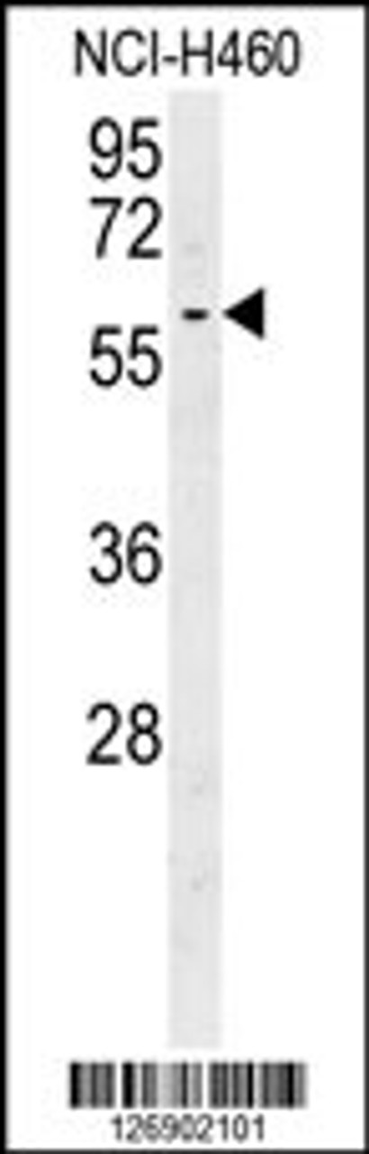 Western blot analysis in NCI-H460 cell line lysates (35ug/lane) .