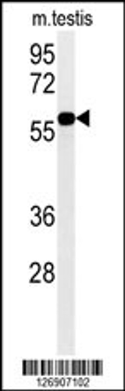 Western blot analysis in mouse testis tissue lysates (35ug/lane) .This demonstrates the detected DKC1 protein (arrow) .