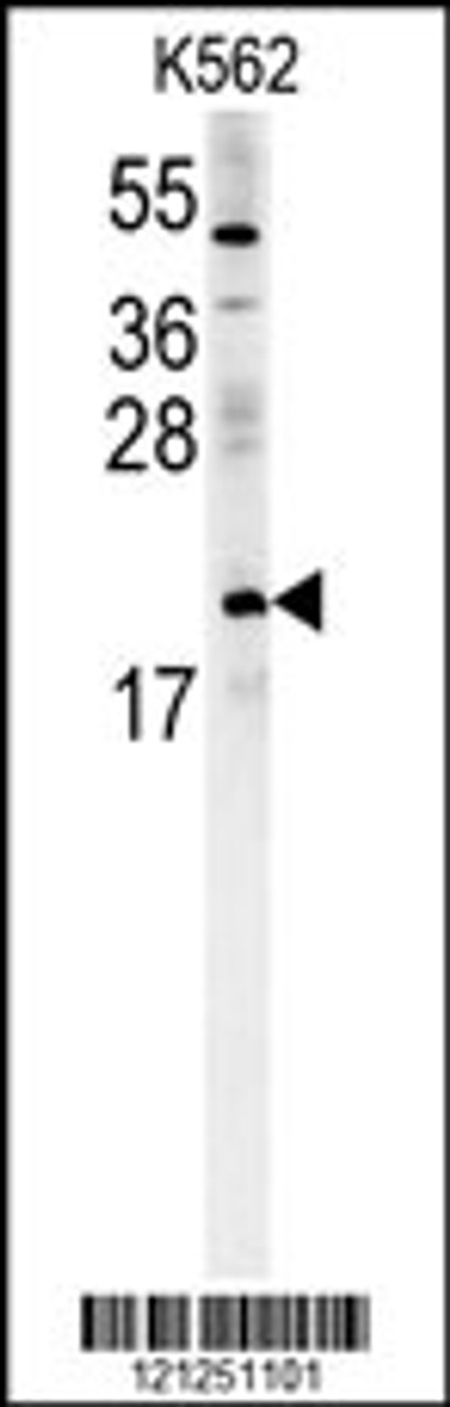 Western blot analysis in K562 cell line lysates (15ug/lane) .