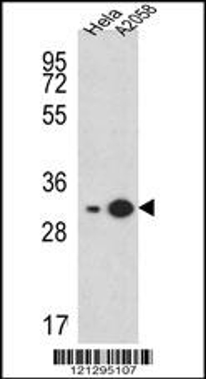 Western blot analysis in Hela, A2058 cell line lysates (15ug/lane) .