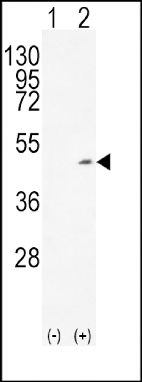 Western blot analysis of ADH1C using rabbit polyclonal ADH1C Antibody using 293 cell lysates (2 ug/lane) either nontransfected (Lane 1) or transiently transfected (Lane 2) with the ADH1C gene.