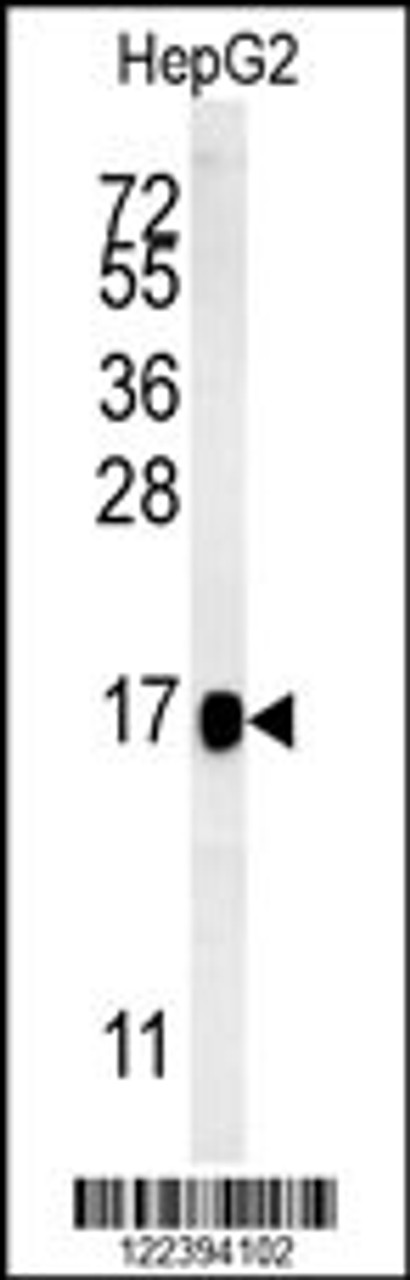 Western blot analysis in HepG2 cell line lysates (15ug/lane) .