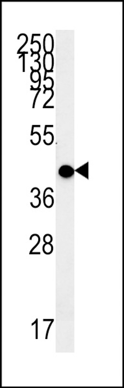 Western blot analysis in WiDr cell line lysates (15ug/lane) .