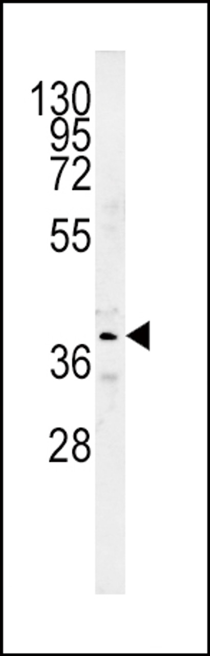 Western blot analysis in mouse kidney tissue lysates (15ug/lane) .This demonstrates the detected SRD5A2 protein (arrow) .