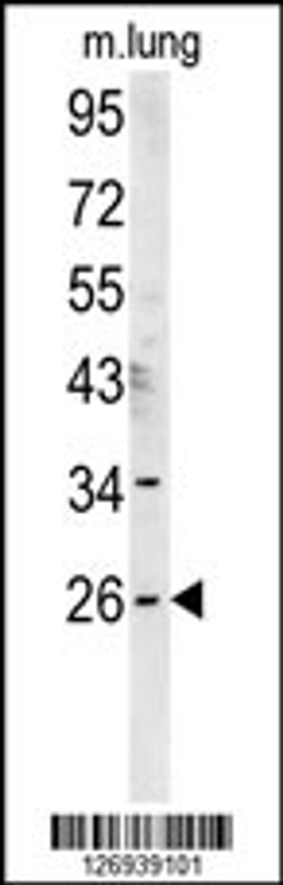 Western blot analysis in mouse lung tissue lysates (15ug/lane) .This demonstrates the detected DNJC8 protein (arrow) .