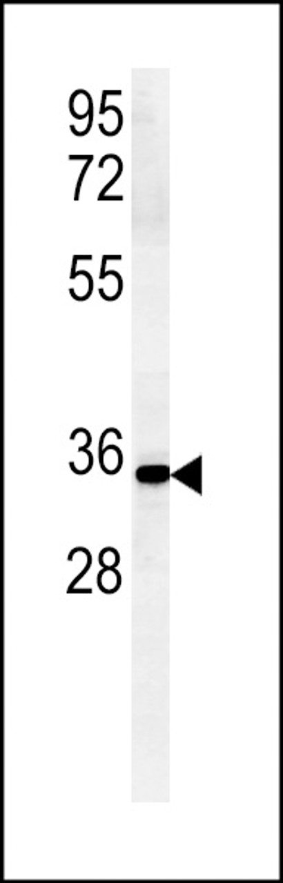 Western blot analysis in mouse Neuro-2a cell line lysates (15ug/lane) .