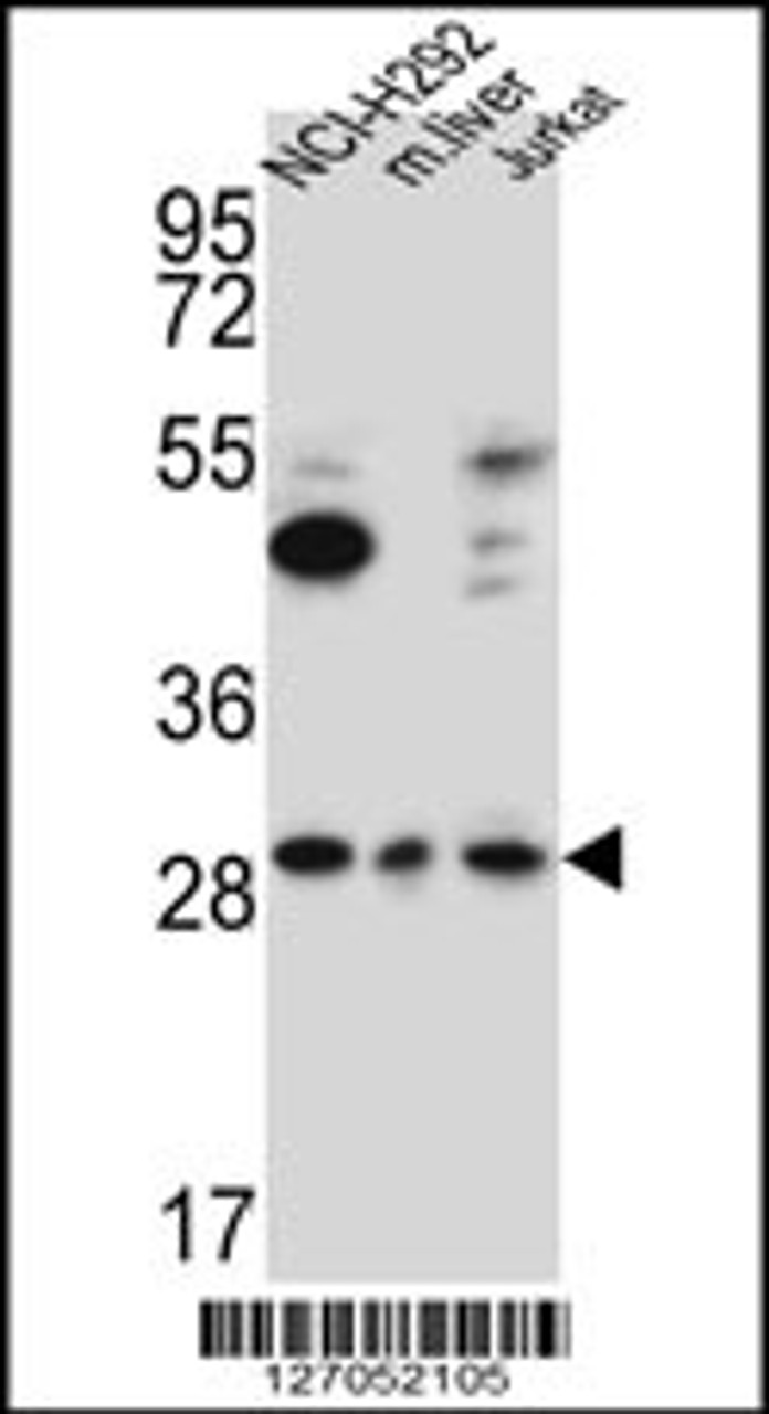 Western blot analysis in NCI-H292, Jurkat cell line and mouse liver lysates (15ug/lane) .