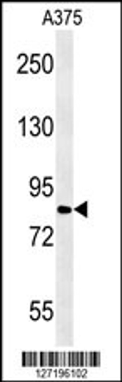 Western blot analysis in A375 cell line lysates (15ug/lane) .