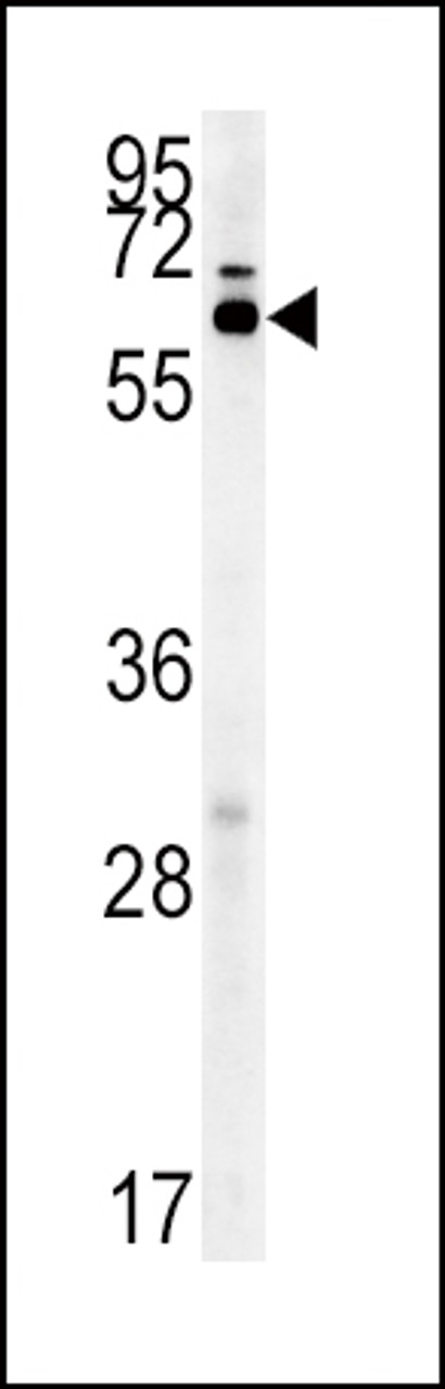 Western blot analysis in mouse liver tissue lysates (15ug/lane) .This demonstrates the detected IKZF3 protein (arrow) .