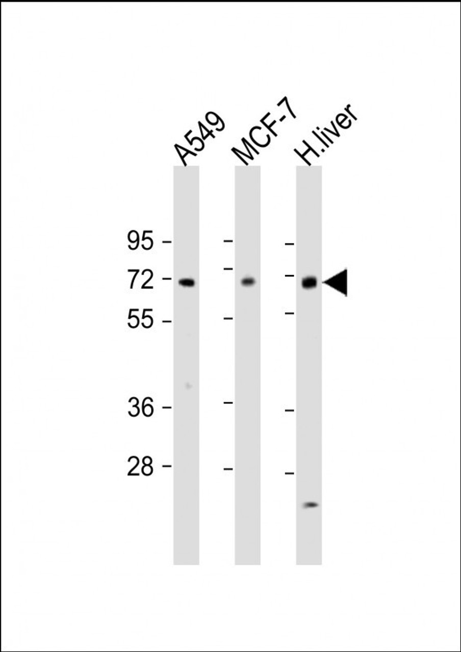 Western Blot at 1:1000-1:2000 dilution Lane 1: A549 whole cell lysate Lane 2: MCF-7 whole cell lysate Lane 3: human liver lysate Lysates/proteins at 20 ug per lane.