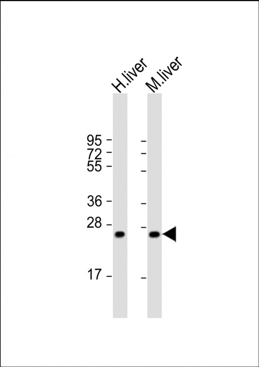 Western Blot at 1:2000 dilution Lane 1: human liver lysate Lane 2: mouse liver lysate Lysates/proteins at 20 ug per lane.