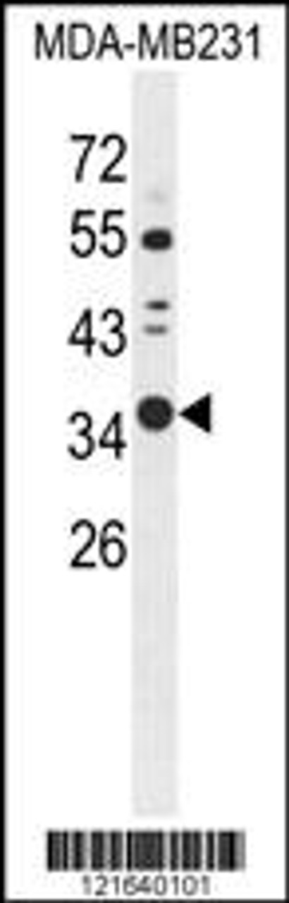 Western blot analysis of STX7 Antibody in MDA-MB231 cell line lysates (35ug/lane)