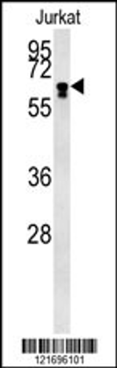 Western blot analysis in Jurkat cell line lysates (15ug/lane) .