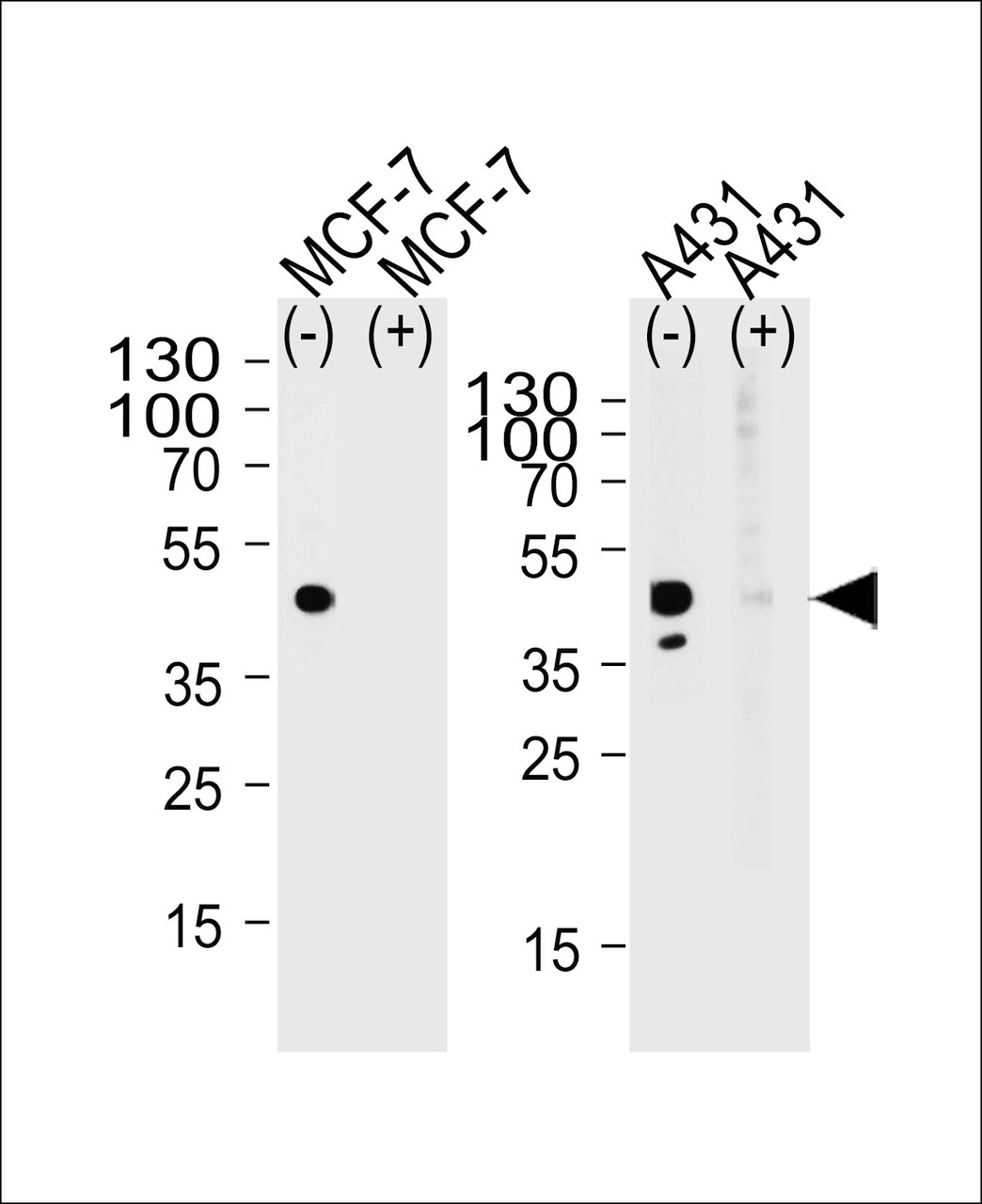 Western blot analysis of lysate from MCF-7, A431 cell line, using CALCR Antibody with (+) or without (-) peptides at 1:1000 at each lane. A goat anti-rabbit (HRP) at 1:5000 dilution was used as the secondary antibody. Lysate at 35ug per lane.