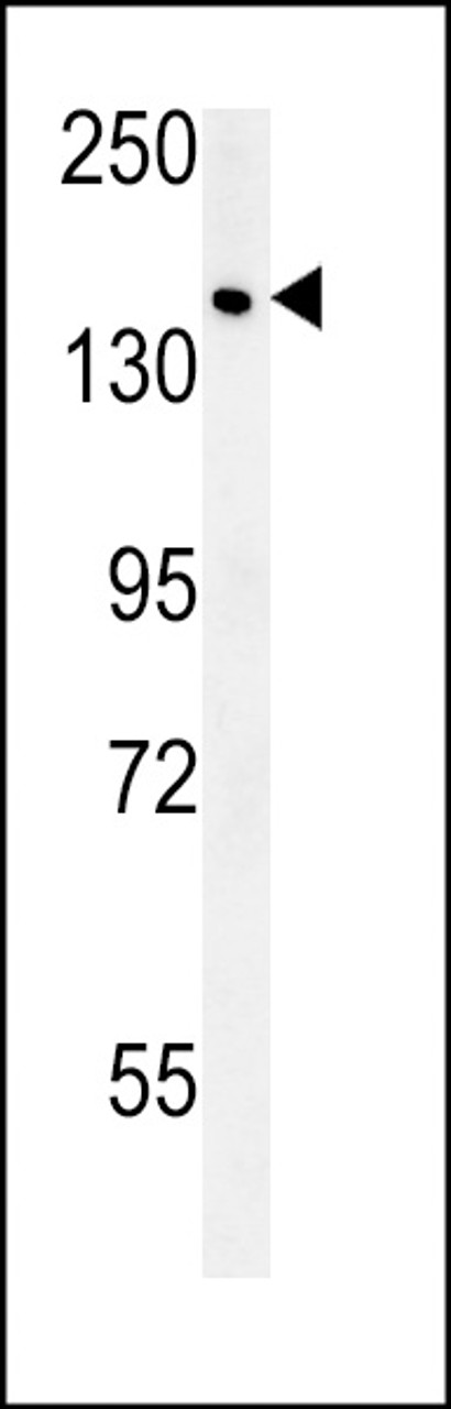 Western blot analysis in MCF-7 cell line lysates (15ug/lane) .