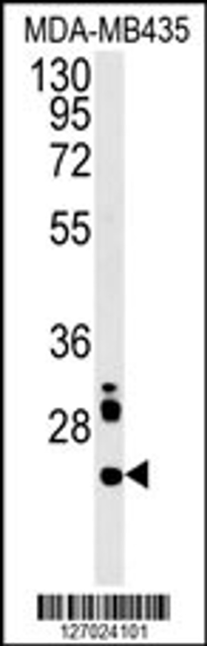 Western blot analysis in MDA-MB435 cell line lysates (15ug/lane) .