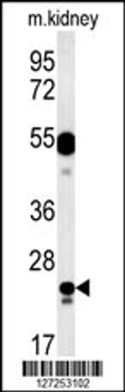 Western blot analysis in mouse kidney tissue lysates (15ug/lane) .This demonstrates the detected LYSMD1 protein (arrow) .