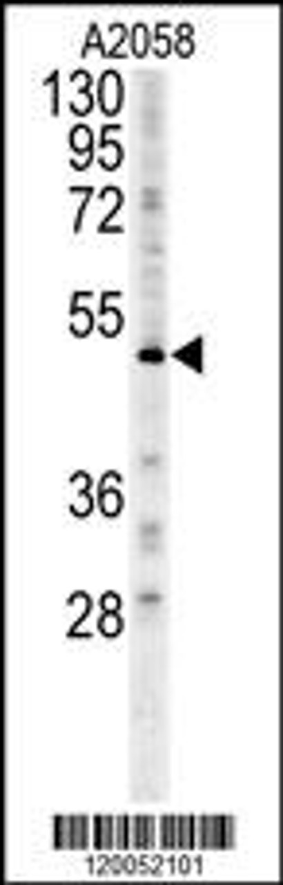 Western blot analysis in A2058 cell line lysates (15ug/lane) .