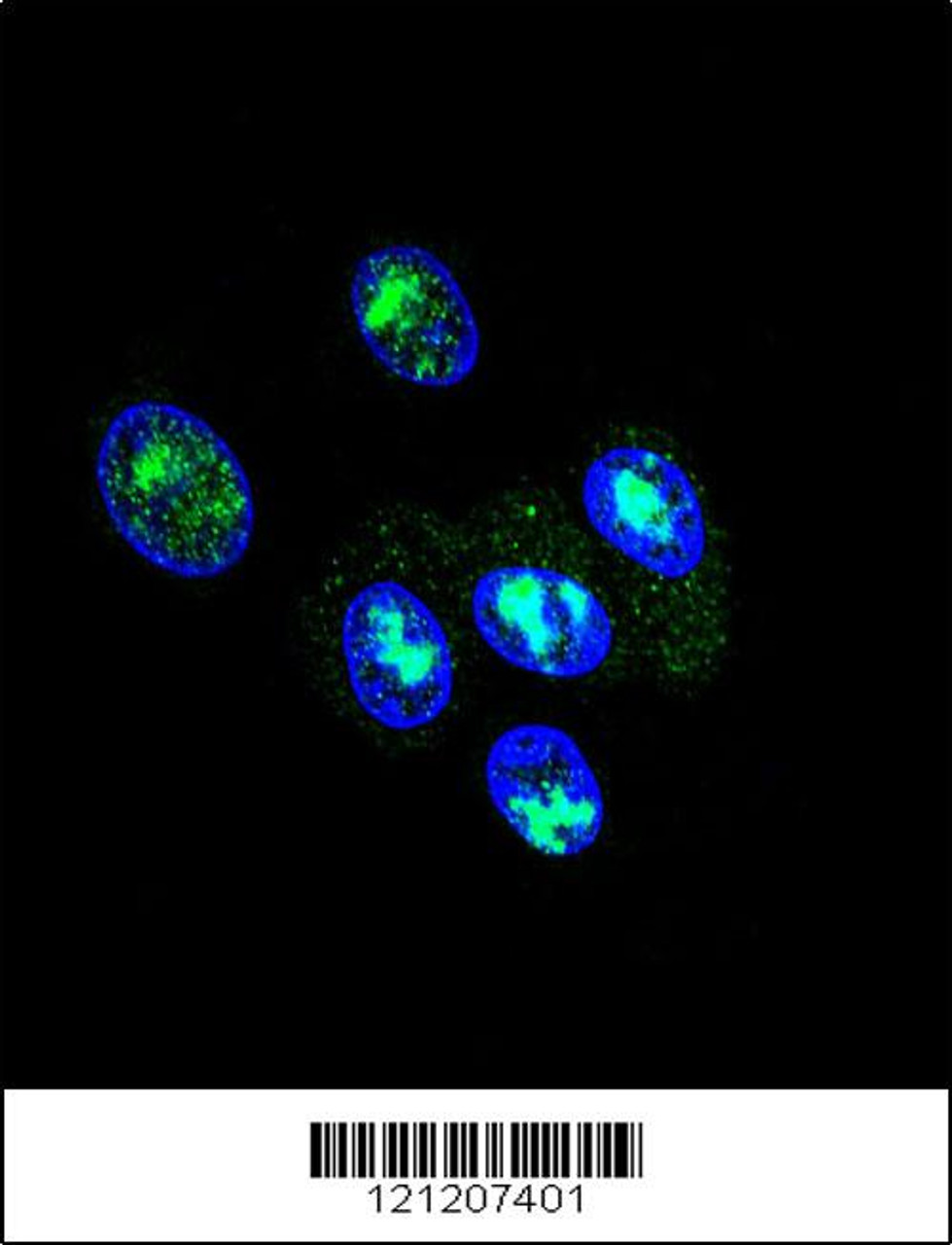 Confocal immunofluorescent analysis of FOXP2 Antibody with HepG2 cell followed by Alexa Fluor 488-conjugated goat anti-rabbit lgG (green) . DAPI was used to stain the cell nuclear (blue) .