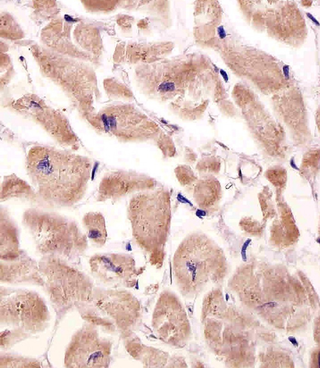 Antibody staining VLDLR in human heart tissue sections by Immunohistochemistry (IHC-P - paraformaldehyde-fixed, paraffin-embedded sections) .