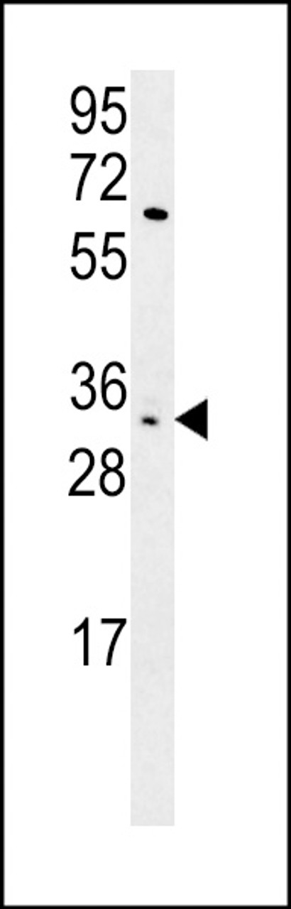 Western blot analysis in HL-60 cell line lysates (15ug/lane) .