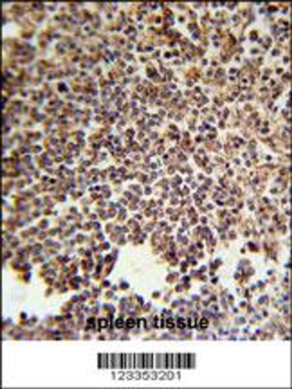 KIR2DS3 Antibody immunohistochemistry analysis in formalin fixed and paraffin embedded human spleen tissue followed by peroxidase conjugation of the secondary antibody and DAB staining.