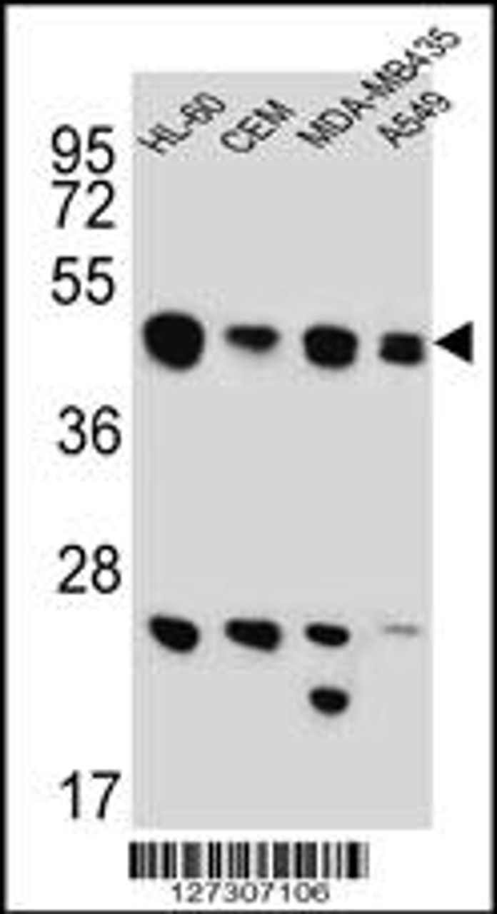 Western blot analysis in HL-60, CEM, MDA-MB435, A549 cell line lysates (15ug/lane) .