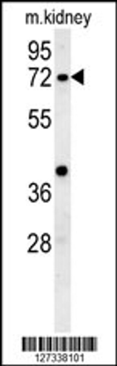 Western blot analysis in mouse kidney tissue lysates (15ug/lane) .This demonstrates the detected KLHL6 protein (arrow) .