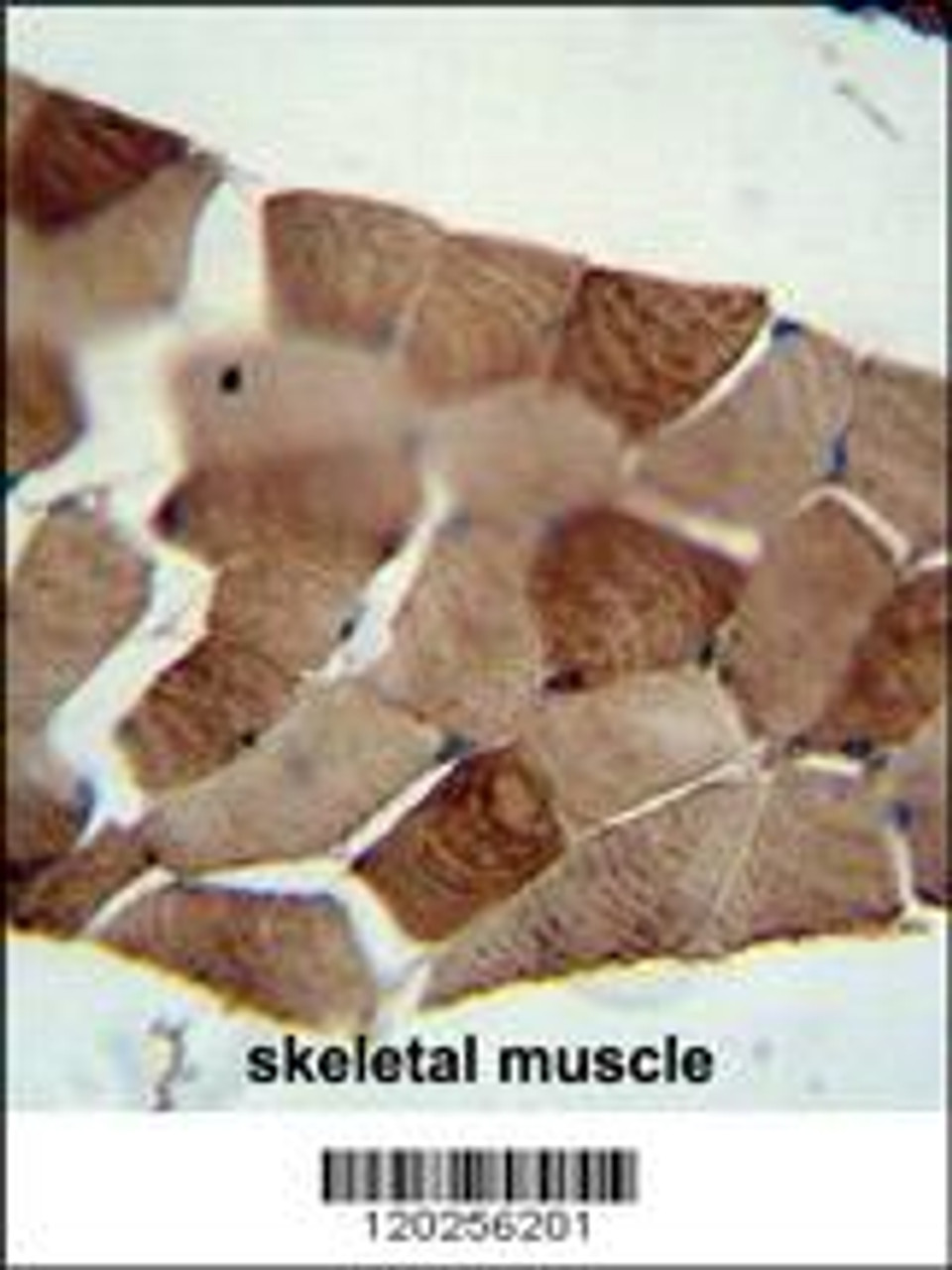 ST3GAL5 antibody immunohistochemistry analysis in formalin fixed and paraffin embedded human skeletal muscle followed by peroxidase conjugation of the secondary antibody and DAB staining.